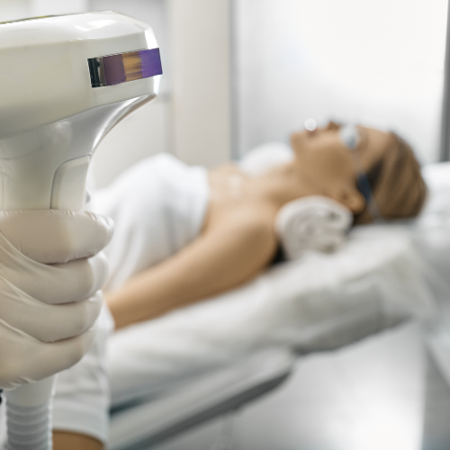 Luz intensa pulsada (IPL)